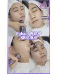 $298 PlaSon​​等離子BB肌療程 